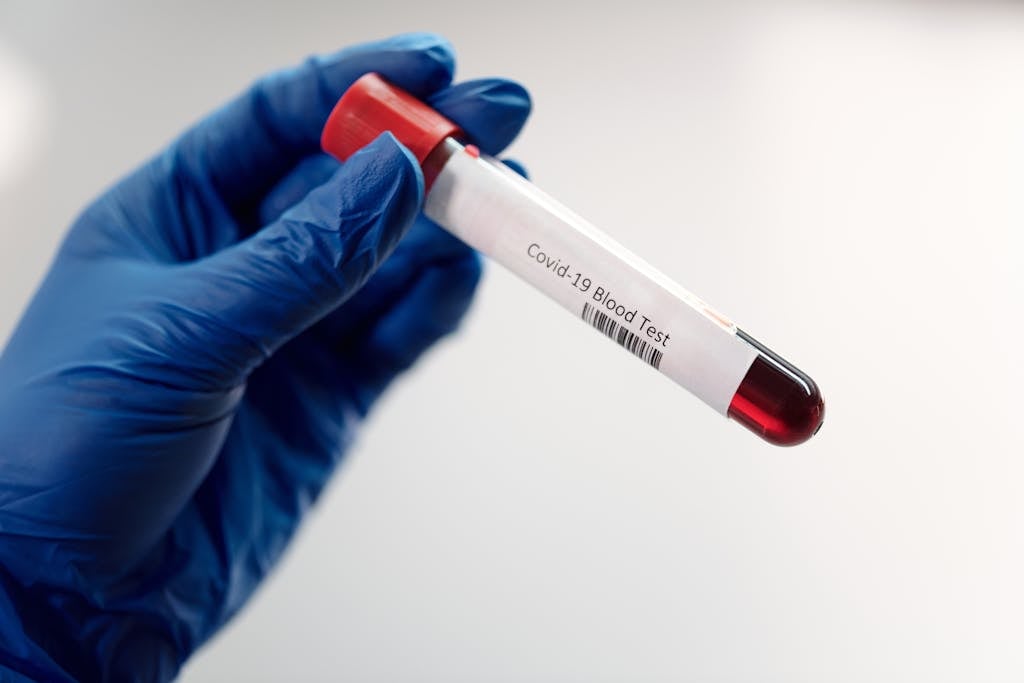 Person Holding a Covid-19 Blood Test